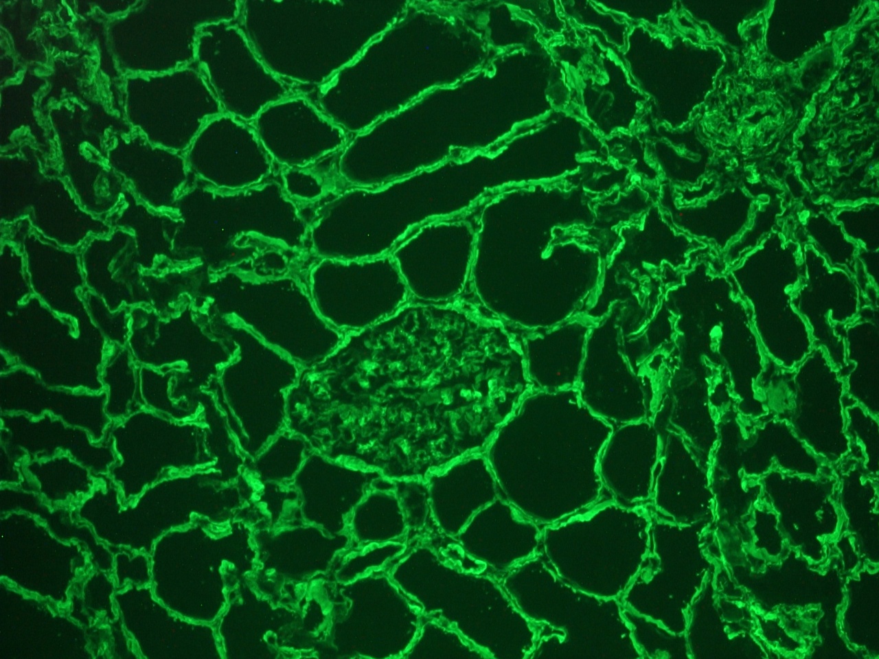 Figure 1: Collagen type IV staining of basement membranes and connective tissue in a frozen section of human kidney using MUB0338S.